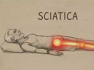 Sciatica is Not From a Slipped Disc. Meet The Real Enemy of Sciatica (Stop This)
