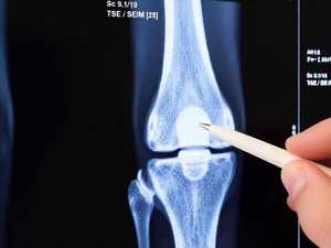 Surgeons: This Simple Trick Will End Knee Pain & Arthritis Quickly (Try It)