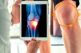 Joint Doctor Begs Seniors to "Repair" Joints With This Tip